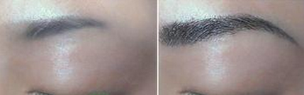 ���ݱ���Ƥ��ר��ҽԺ�����߸߻ᵼ��ͺ��������