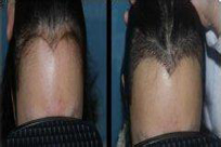 ���ݱ���Ƥ��ר��ҽԺ��Щϰ�����ѷ��й���