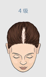 ���ݱ���Ƥ��ר��ҽԺ��Щϰ���ܹ���������Ԥ���ѷ�