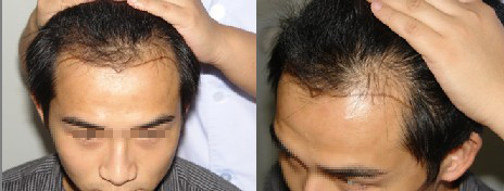 ���ݱ���Ƥ��ר��ҽԺͷ������������ô��