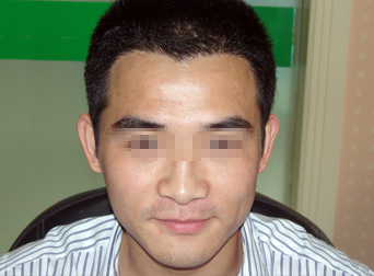 ���ݱ���Ƥ��ר��ҽԺͷ����ֲ������