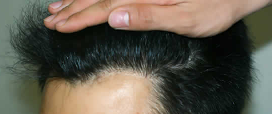 ���ݱ���Ƥ��ר��ҽԺŮ���������ߵ�����������