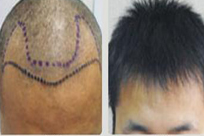 ���ݱ���Ƥ��ר��ҽԺ����ᷢ��