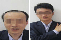 ���ݱ���Ƥ��ר��ҽԺ���üëë�һ�������ô���޸���