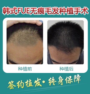 ���ݱ���Ƥ��ר��ҽԺ��ʲô�취���޽ǳ��ÿ죿