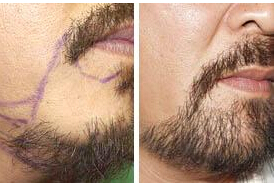 ���ݱ���Ƥ��ר��ҽԺ��ʲô�õķ���������ͷ������أ�