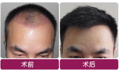 ��ʲô�ѷ�ʳ��