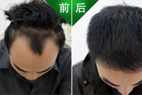 ���ݱ���Ƥ��ר��ҽԺ���˺��ӳ���̫����ô�죿