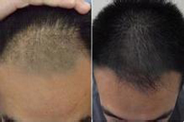 ���ݱ���Ƥ��ר��ҽԺ���Ի����ѷ���ʲôΣ��