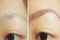 ���ݱ���Ƥ��ר��ҽԺ�����ѷ���ʲô���Ե�����