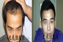 ���ݱ���Ƥ��ר��ҽԺ�̺��޸����ŵ㼰��Ӧ��Щ��Ⱥ�أ�