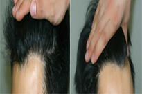 ���ݱ���Ƥ��ר��ҽԺ�̺��ѷ���������ƣ�