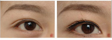 ���ݱ���Ƥ��ר��ҽԺ��ֲ��ëЧ���ò����أ�