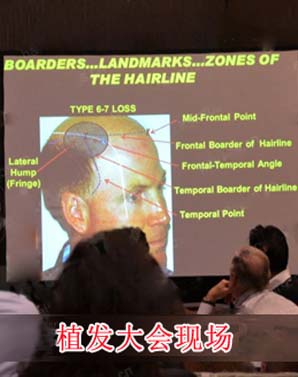 ���ݱ���Ƥ��ר��ҽԺ��ë��ֲЧ����Σ�