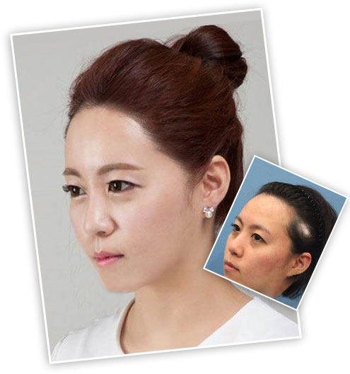 ���ݱ���Ƥ��ר��ҽԺ֬�����ѷ�Ӧ��ע����Щ