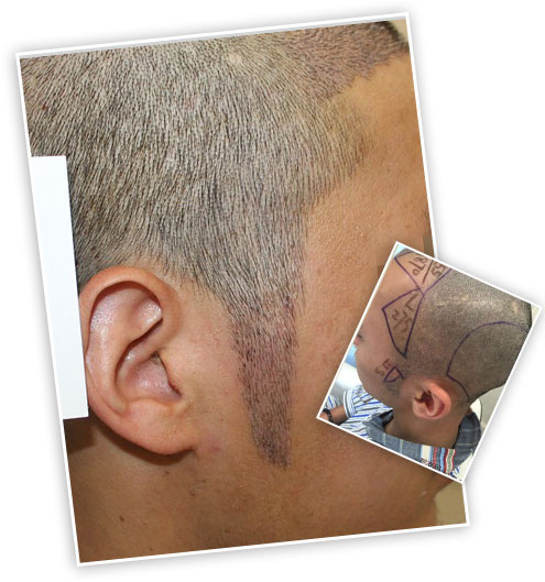 ���ݱ���Ƥ��ר��ҽԺ֬�����ѷ�����ͷ�����ܳ�������