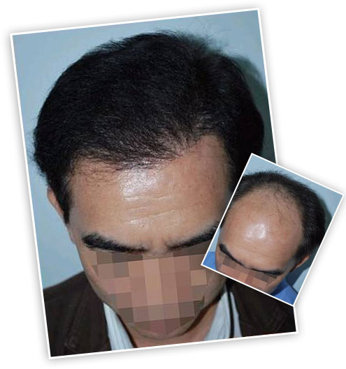 ���ݱ���Ƥ��ר��ҽԺ�ѷ������Ҫ������Щ