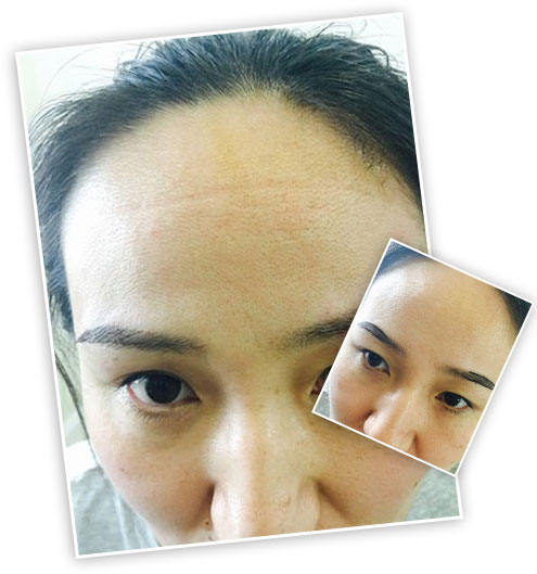 ���ݱ���Ƥ��ר��ҽԺ��ë��ֲ�᲻���и����ã�