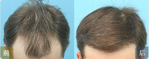 ���ݱ���Ƥ��ר��ҽԺ��ëë����ֲ��ʲô��