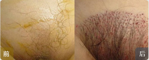 ���ݱ���Ƥ��ר��ҽԺ�������ѷ�ԭ������Щ