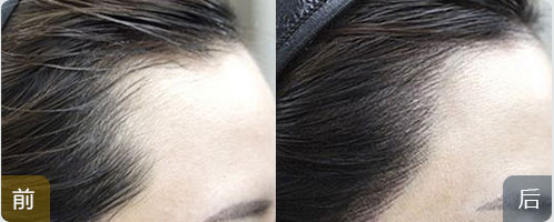 ���ݱ���Ƥ��ר��ҽԺ��ͷ�ߡ�ͷ����,��ô�죿